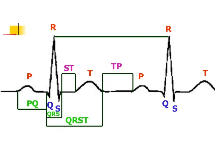 P P R R T T Q Q S S PQ QRS QRST ST TP