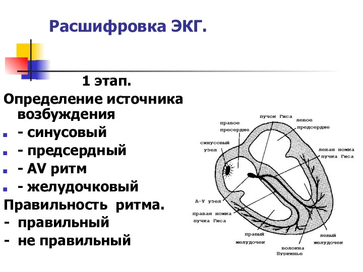 Расшифровка ЭКГ. 1 этап. Определение источника возбуждения - синусовый - предсердный