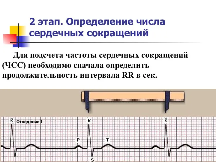 2 этап. Определение числа сердечных сокращений Для подсчета частоты сердечных сокращений