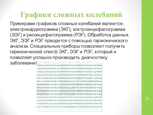 Графики сложных колебаний Примерами графиков сложных колебаний являются: электрокардиограмма (ЭКГ), элктроэнцефалограмма