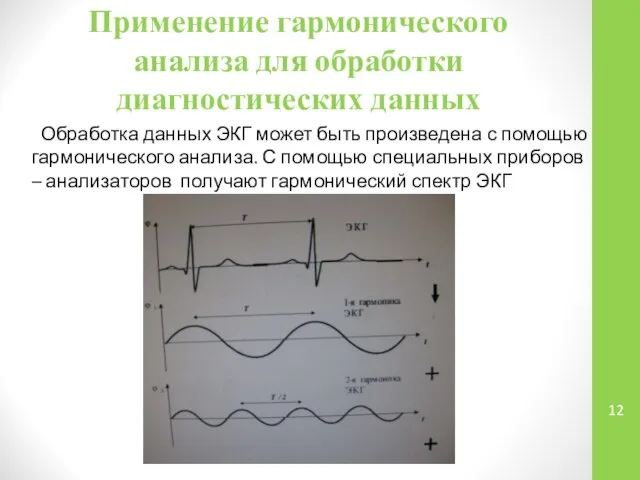 Применение гармонического анализа для обработки диагностических данных Обработка данных ЭКГ может