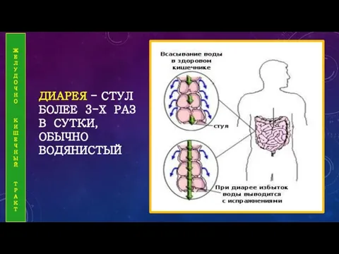 ДИАРЕЯ - СТУЛ БОЛЕЕ 3-Х РАЗ В СУТКИ, ОБЫЧНО ВОДЯНИСТЫЙ Ж