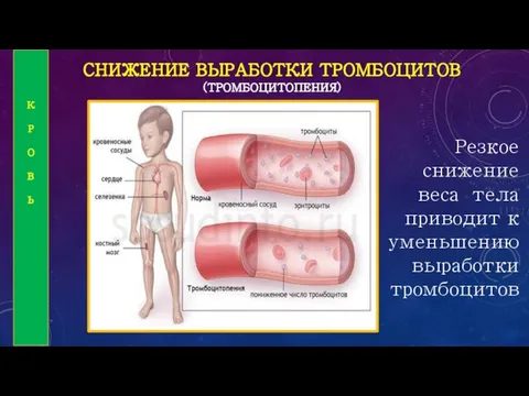 СНИЖЕНИЕ ВЫРАБОТКИ ТРОМБОЦИТОВ (ТРОМБОЦИТОПЕНИЯ) Резкое снижение веса тела приводит к уменьшению