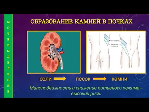 ОБРАЗОВАНИЕ КАМНЕЙ В ПОЧКАХ соли песок камни Малоподвижность и снижение питьевого