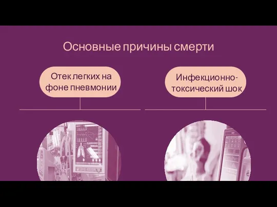 Основные причины смерти Отек легких на фоне пневмонии Инфекционно-токсический шок