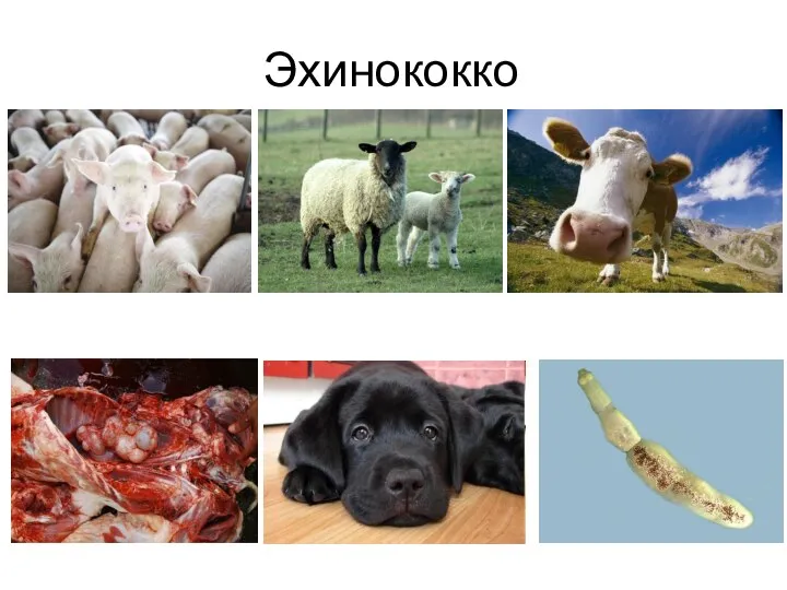 Эхинококкоз