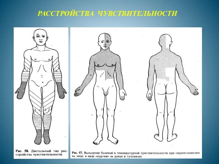 РАССТРОЙСТВА ЧУВСТВИТЕЛЬНОСТИ