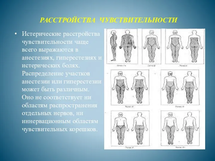 РАССТРОЙСТВА ЧУВСТВИТЕЛЬНОСТИ Истерические расстройства чувствительности чаще всего выражаются в анестезиях, гиперестезиях