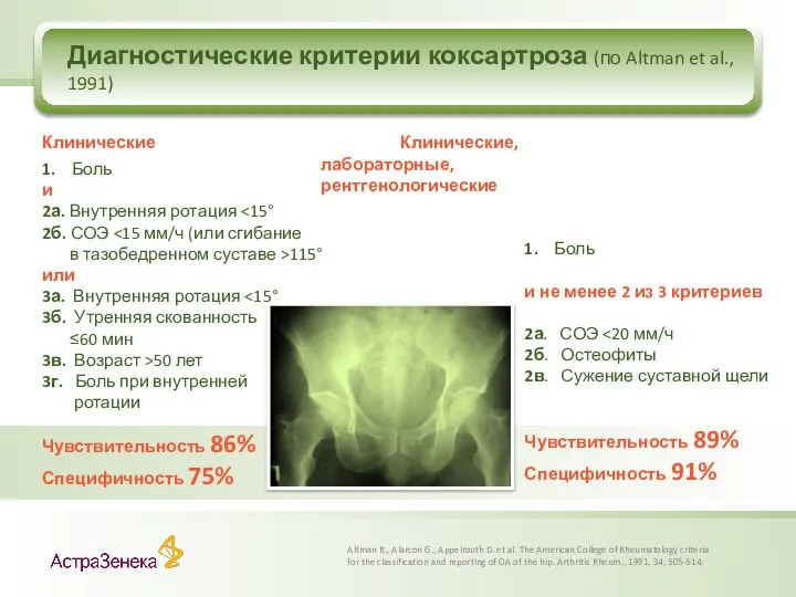 Диагностические критерии коксартроза (по Altman et al., 1991) Altman R., Alarcon