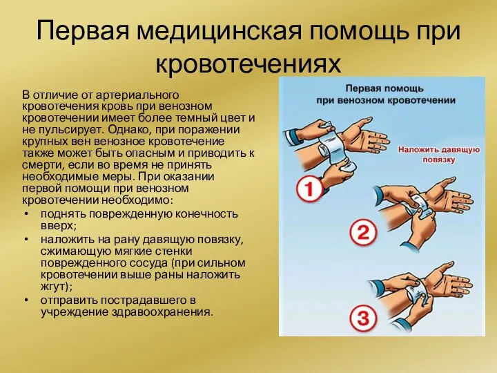 Первая медицинская помощь при кровотечениях В отличие от артериального кровотечения кровь