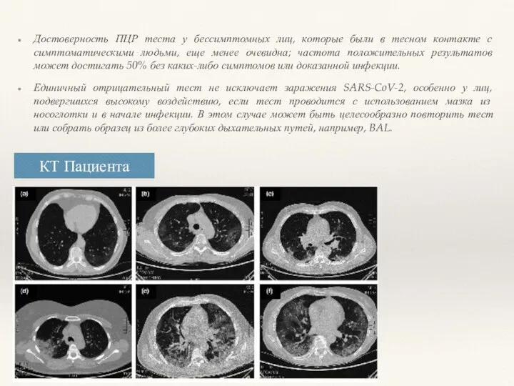 Достоверность ПЦР теста у бессимптомных лиц, которые были в тесном контакте