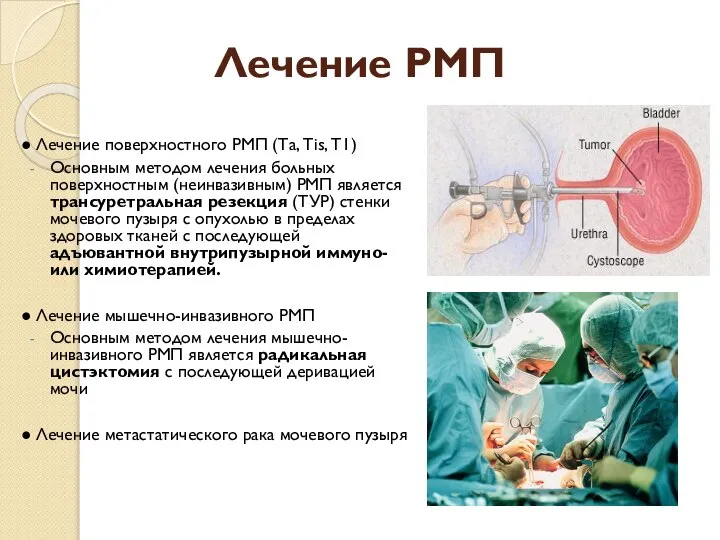 Лечение РМП ● Лечение поверхностного РМП (Та, Тis, Т1) Основным методом