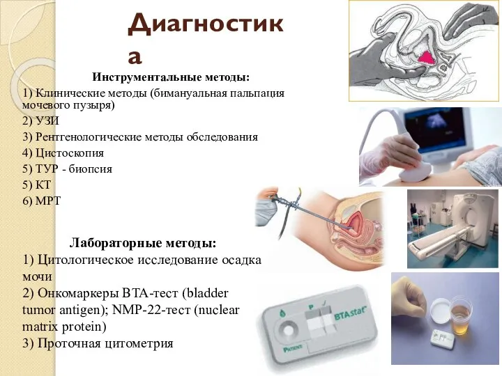 Диагностика Инструментальные методы: 1) Клинические методы (бимануальная пальпация мочевого пузыря) 2)