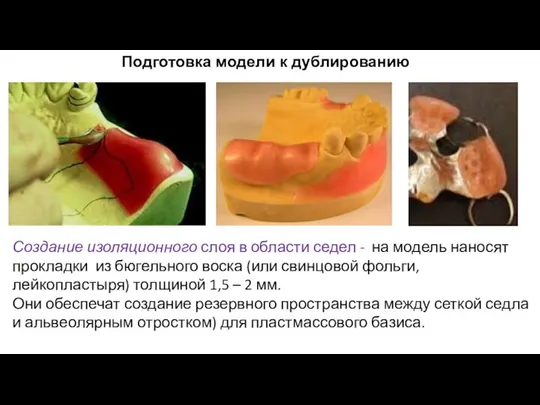 Подготовка модели к дублированию Создание изоляционного слоя в области седел -