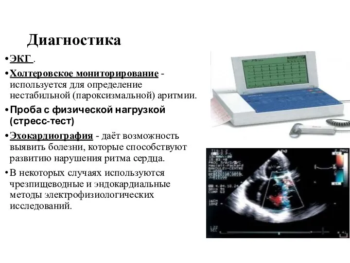 Диагностика ЭКГ . Холтеровское мониторирование - используется для определение нестабильной (пароксизмальной)