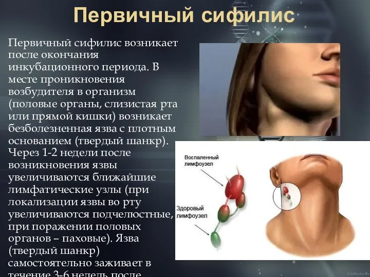 Первичный сифилис Первичный сифилис возникает после окончания инкубационного периода. В месте