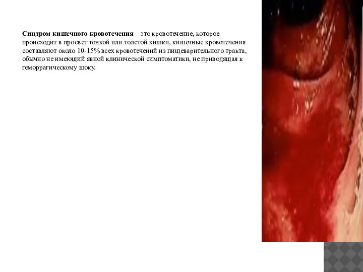 Синдром кишечного кровотечения – это кровотечение, которое происходит в просвет тонкой