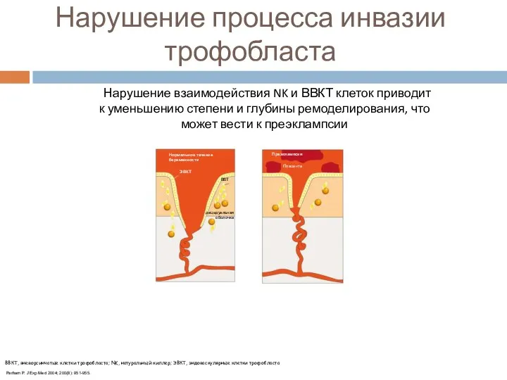 Нарушение процесса инвазии трофобласта Нарушение взаимодействия NK и ВВКТ клеток приводит