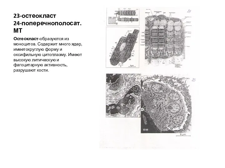 23-остеокласт 24-поперечнополосат.МТ Остеокласт-образуются из моноцитов. Содержит много ядер, имеетокруглую форму и