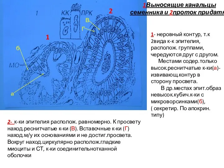 1Выносящие канальцы семенника и 2проток придатка 1 2 1- неровный контур,