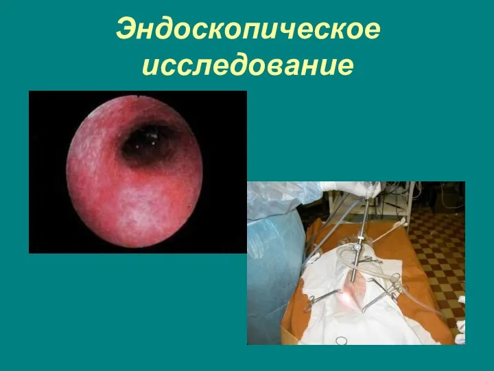 Эндоскопическое исследование