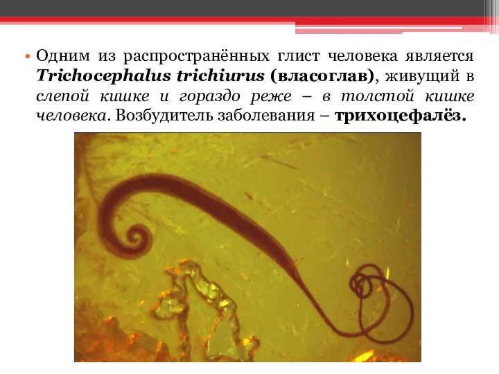 Одним из распространённых глист человека является Trichocephalus trichiurus (власоглав), живущий в