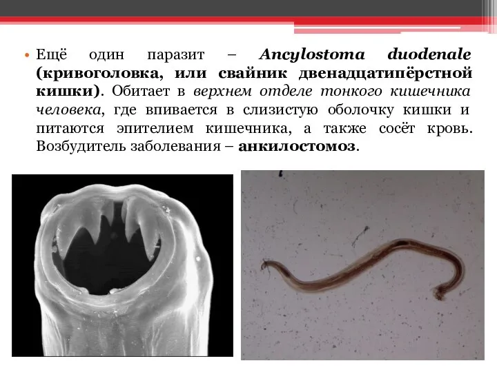 Ещё один паразит – Ancylostoma duodenale (кривоголовка, или свайник двенадцатипёрстной кишки).