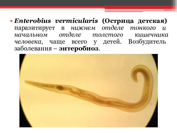 Enterobius vermicularis (Острица детская) паразитирует в нижнем отделе тонкого и начальном