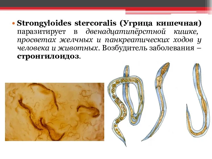 Strongyloides stercoralis (Угрица кишечная) паразитирует в двенадцатипёрстной кишке, просветах желчных и