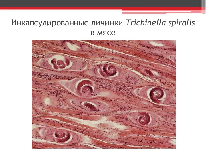 Инкапсулированные личинки Trichinella spiralis в мясе