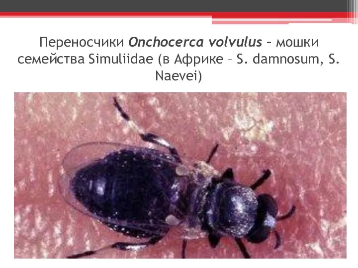 Переносчики Onchocerca volvulus – мошки семейства Simuliidae (в Африке – S. damnosum, S. Naevei)