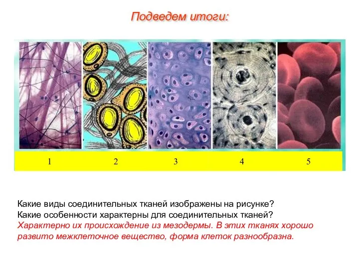 Какие виды соединительных тканей изображены на рисунке? Какие особенности характерны для