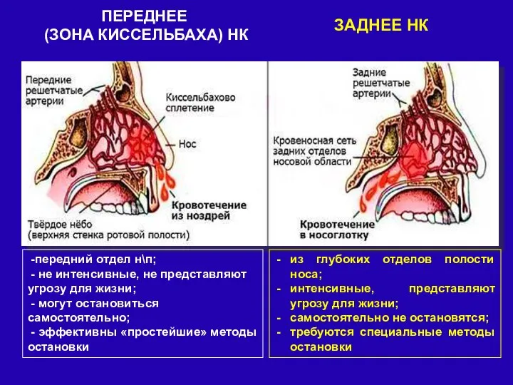 -передний отдел н\п; - не интенсивные, не представляют угрозу для жизни;