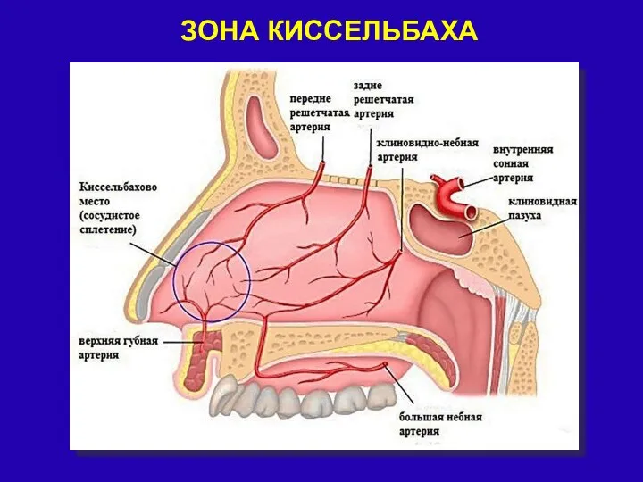 ЗОНА КИССЕЛЬБАХА