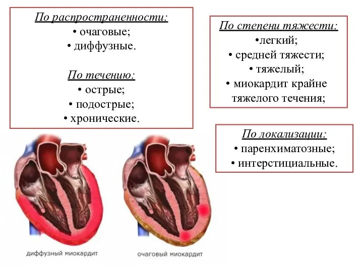 По распространенности: • очаговые; • диффузные. По течению: • острые; •