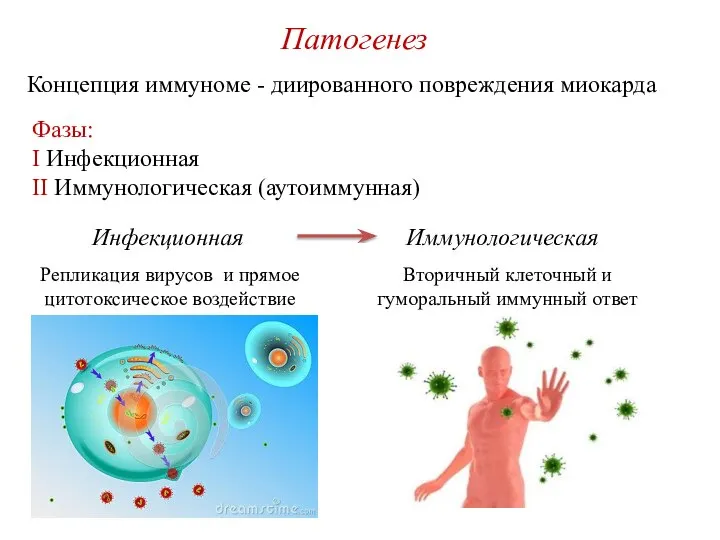 Патогенез Концепция иммуноме - диированного повреждения миокарда Фазы: I Инфекционная II