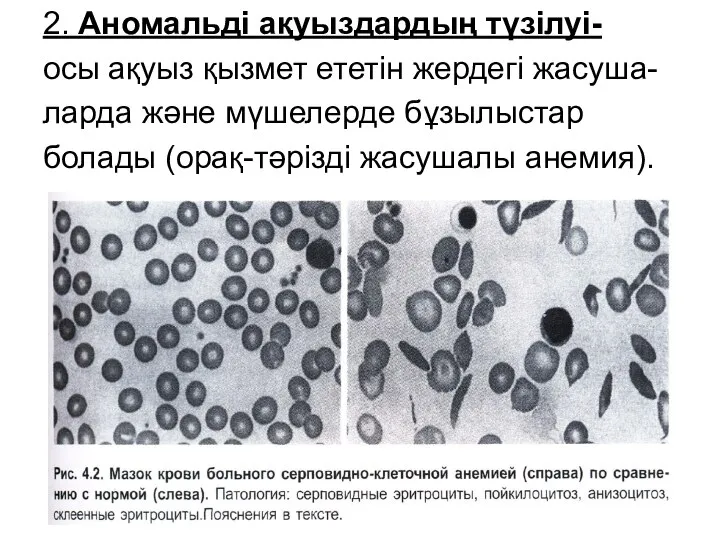 2. Аномальді ақуыздардың түзілуі- осы ақуыз қызмет ететін жердегі жасуша- ларда