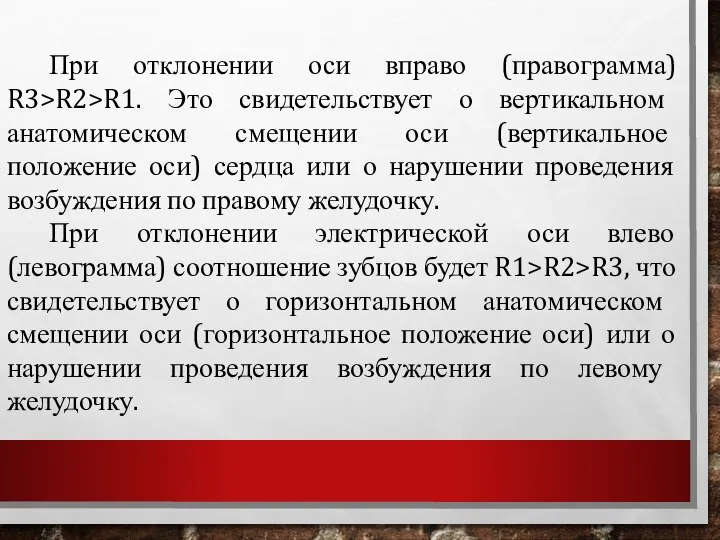 При отклонении оси вправо (правограмма) R3>R2>R1. Это свидетельствует о вертикальном анатомическом