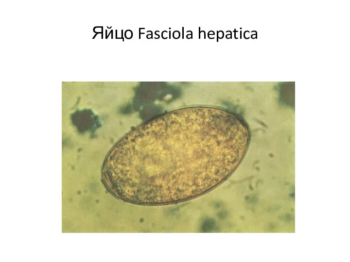 Яйцо Fasciola hepatica