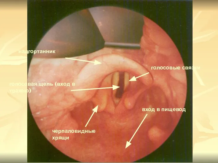 надгортанник голосовые связки голосовая щель (вход в трахею) вход в пищевод черпаловидные хрящи