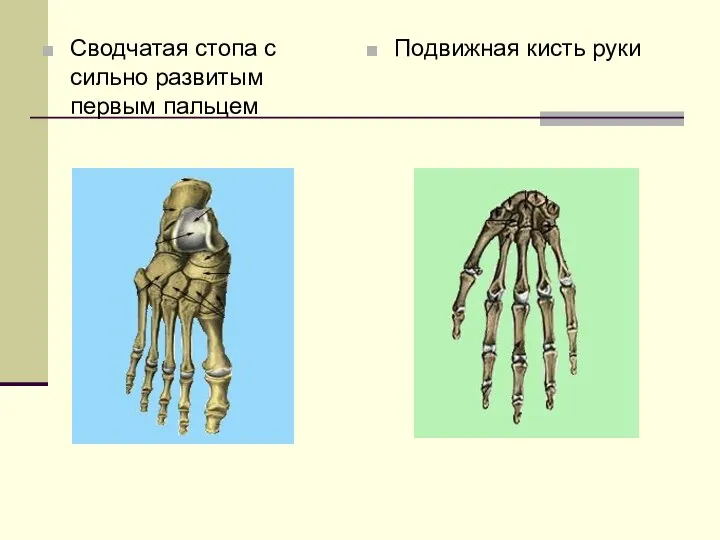 Сводчатая стопа с сильно развитым первым пальцем Подвижная кисть руки