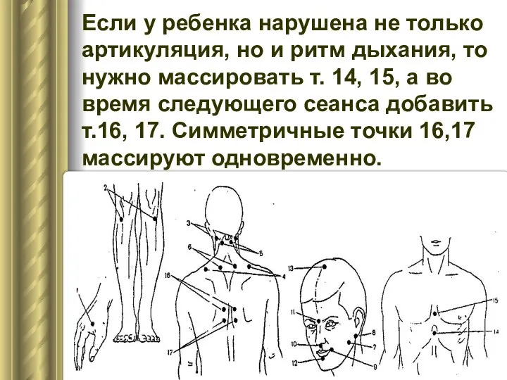 . Если у ребенка нарушена не только артикуляция, но и ритм