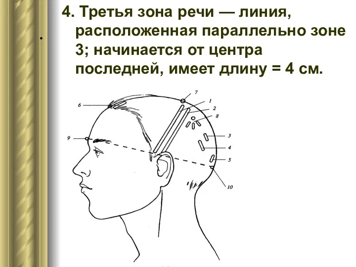 . 4. Третья зона речи — линия, расположенная параллельно зоне 3;