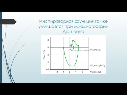 Инспираторная функция также улучшается при миодистрофии Дюшенна