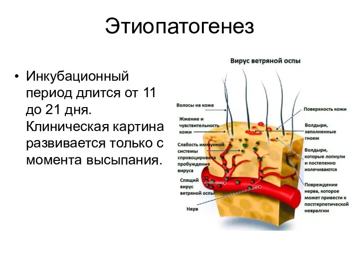 Этиопатогенез Инкубационный период длится от 11 до 21 дня. Клиническая картина развивается только с момента высыпания.