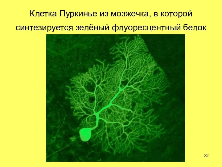 Клетка Пуркинье из мозжечка, в которой синтезируется зелёный флуоресцентный белок