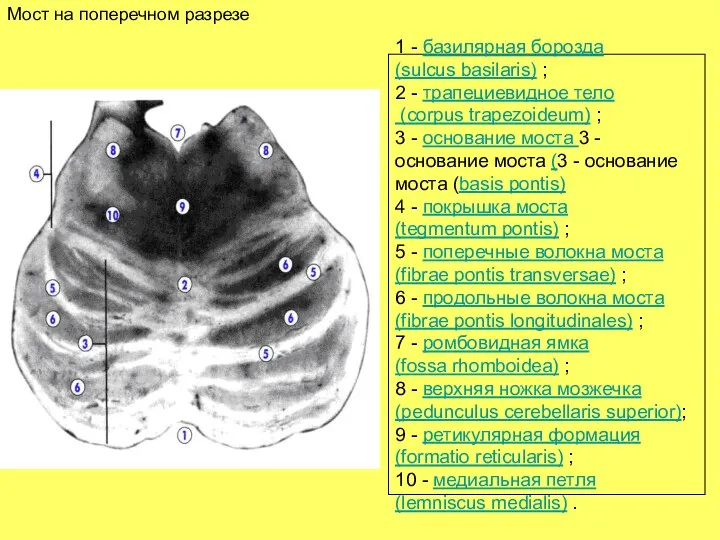 Мост на поперечном разрезе 1 - базилярная борозда (sulcus basilaris) ;