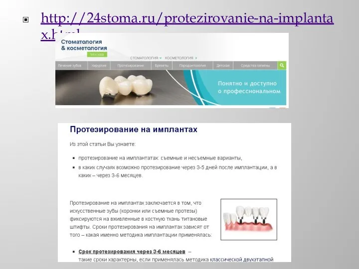 http://24stoma.ru/protezirovanie-na-implantax.html