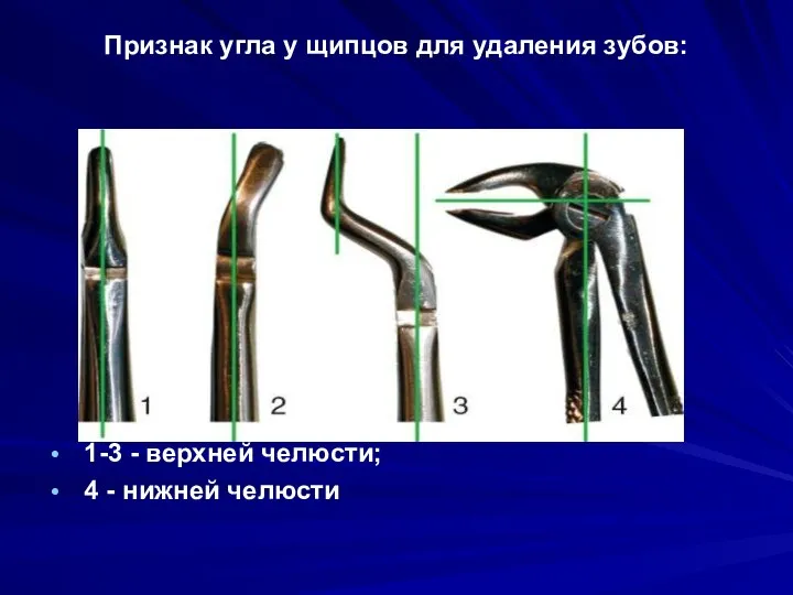 Признак угла у щипцов для удаления зубов: 1-3 - верхней челюсти; 4 - нижней челюсти