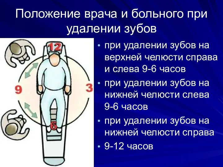 Положение врача и больного при удалении зубов при удалении зубов на